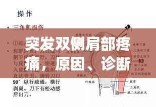 突发双侧肩部疼痛,原因、诊断及有效治疗方法全解析